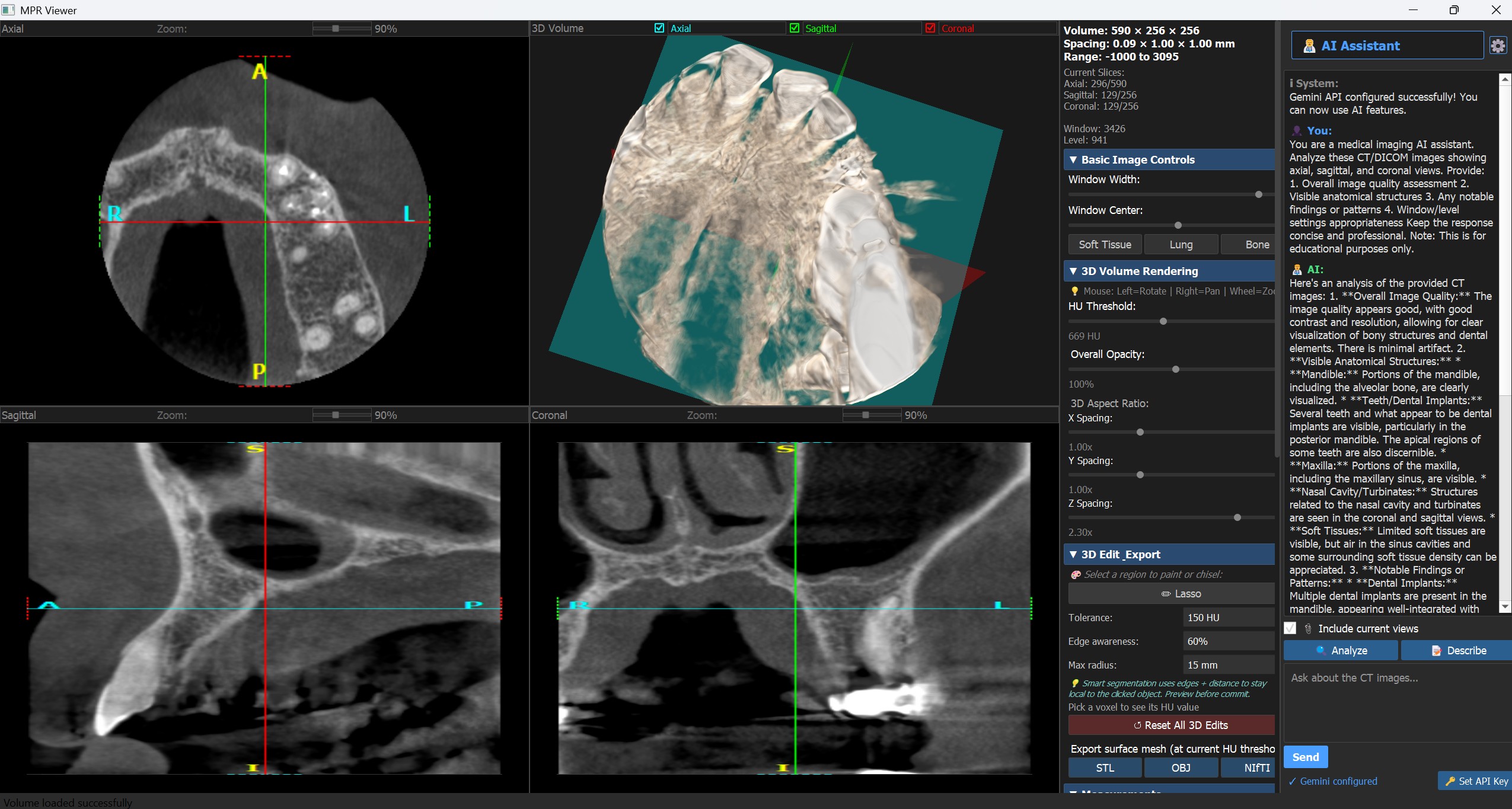 MPR Viewer Screenshot showing dental CT scan with axial, sagittal, coronal views and 3D volume rendering